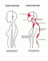 poor-posture-affecting-women-233x300