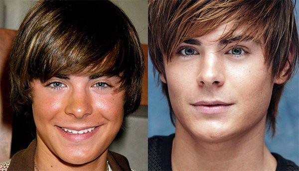 Dr Gavin Dry: Zac Efron before-and-after photos