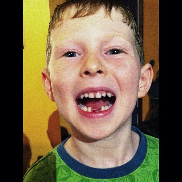My son lost his second tooth! #igerswinnipeg #igersmanitoba #igerscanada #igdaily #igaddict #statigram #kimija