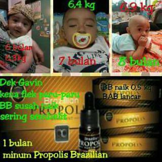 www.markusandika.tk  Brazilian propolis moment sangat berguna untuk adik bayi ini yang menderita sakit.   Wa: 089647157149 Pin 7dd72723  #moment #propolis #brazilian #bisnis #muda #olshop #lebah #ajaib