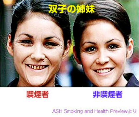 喫煙とは：有害な活性酸素で体を劣化させる...